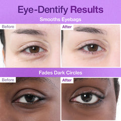 numbuzin No.9 NAD Under Eye Patches (5ea)