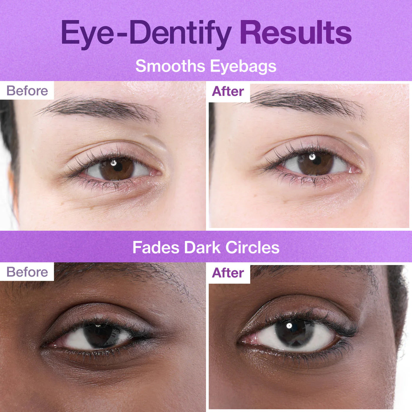 numbuzin No.9 NAD Under Eye Patches (5ea)