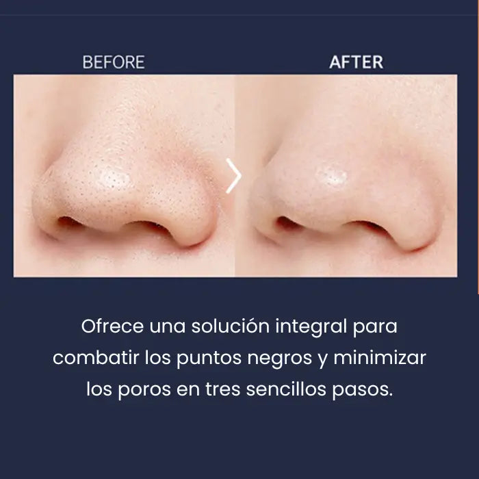 A'PIEU Goblin 3-Step Nose Mask Set (1 Set / 3 Pieces) A'PIEU
