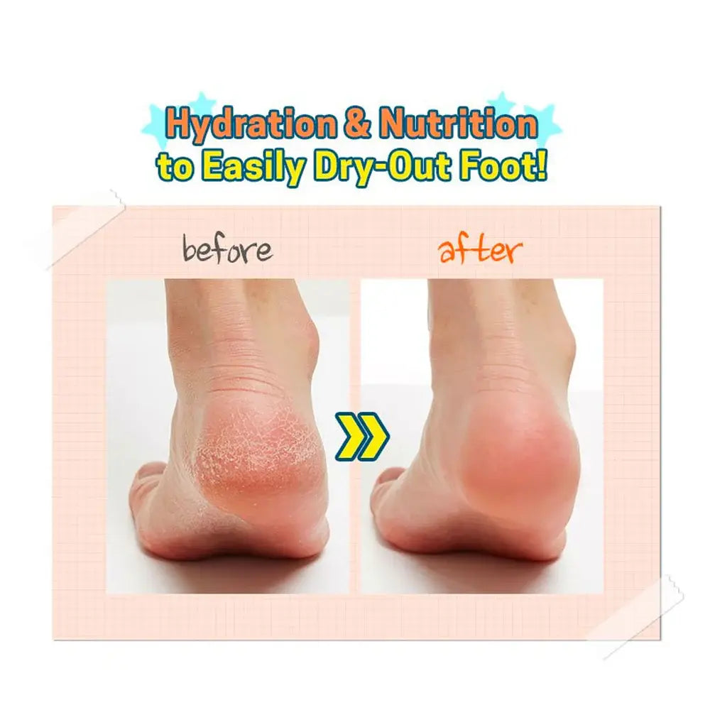 A'pieu Soft Foot 30Minute Peeling Socks - Seouléa