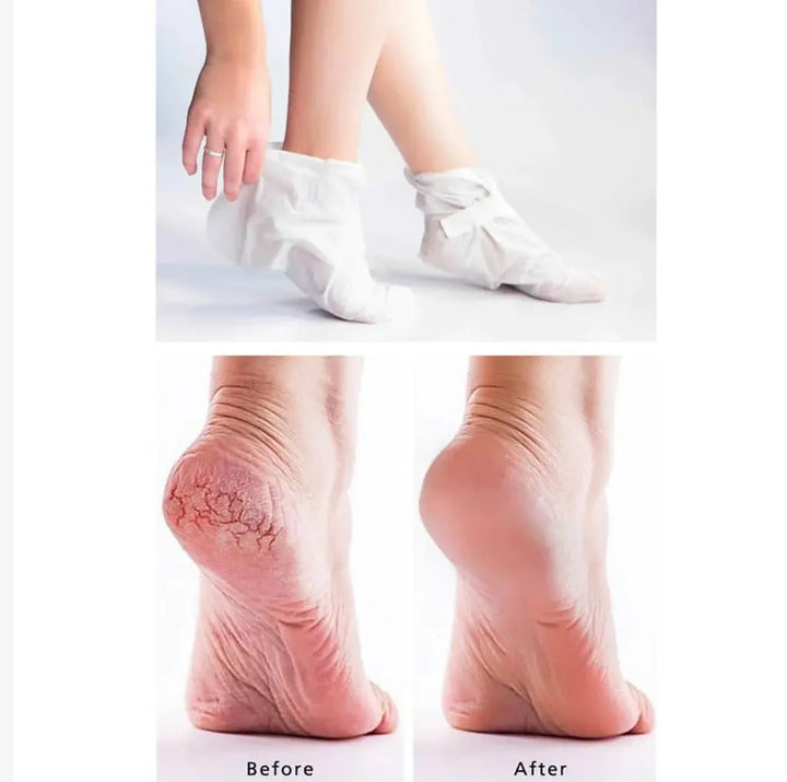 Farmstay Essential Foot Mask – 1 Pair Farmstay