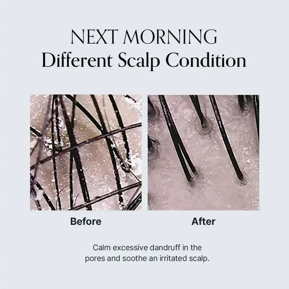 GROWUS Damage Therapy Scalp Ampoule GROWUS