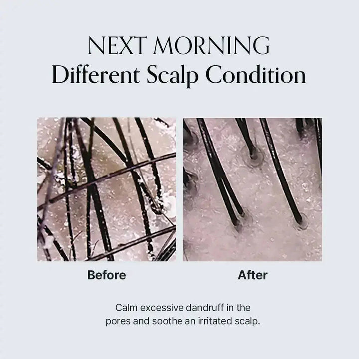 GROWUS Damage Therapy Scalp Ampoule GROWUS