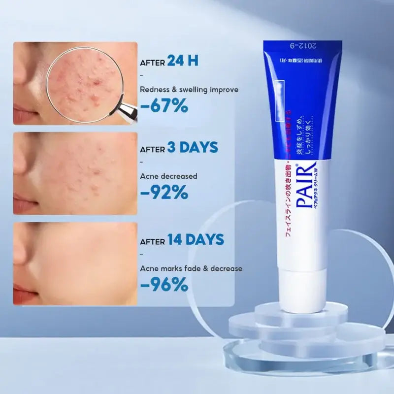 LION Pair Acne Cream W - Seouléa