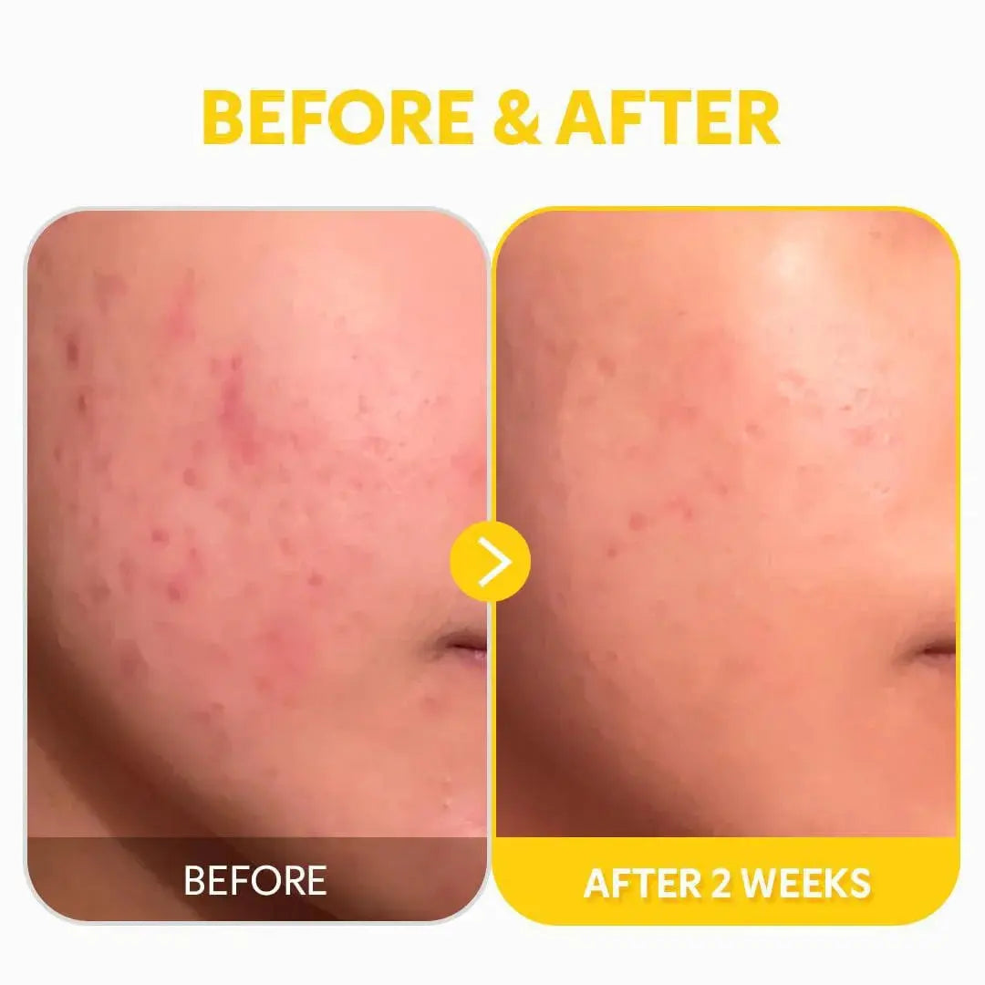 TIRTIR Pure Vitamin C Face Serum TIRTIR