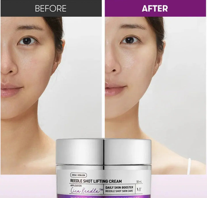 VT Reedle Shot Face Cream (50ml) VT Cosmetics