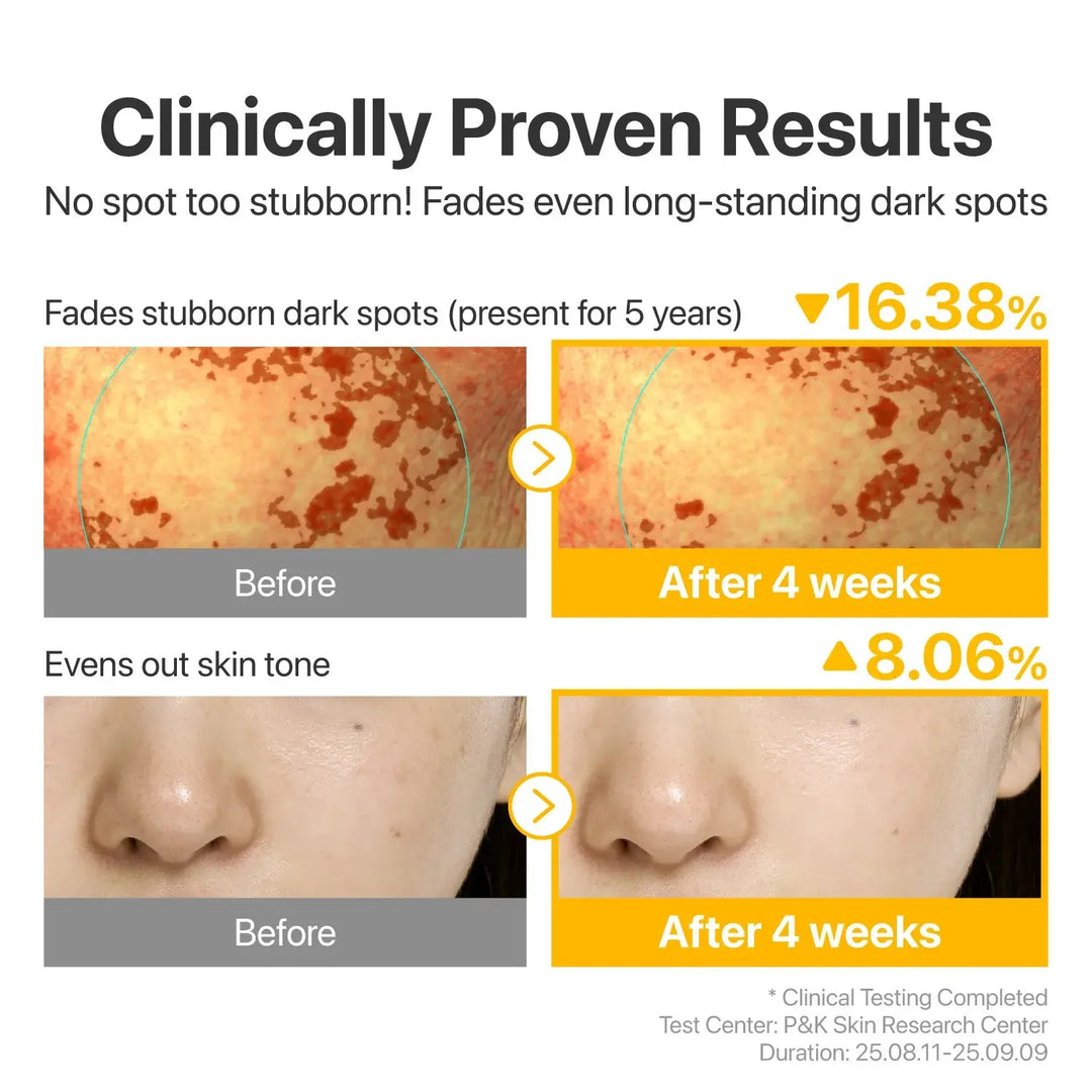 numbuzin No.5 Glutathione TXA Advanced Dark Spot Ampoule Concentrate - Seouléa